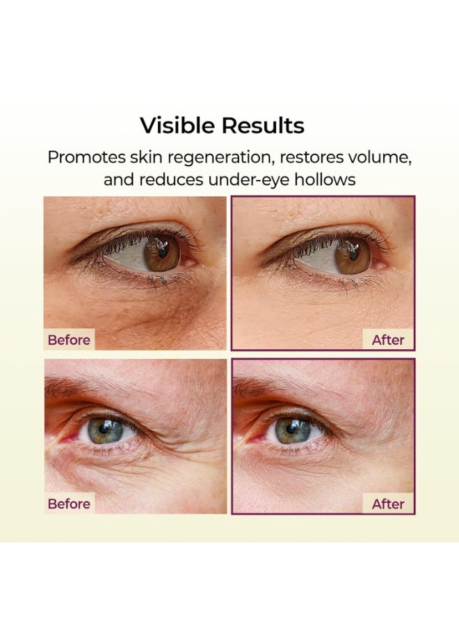 دكتور ميلاكسين د. ميلاكسين بلسم سيمينريت بالكالسيوم متعدد الاستخدامات | 9 جم | عصا كولاجين لزيادة الامتلاء وعلاج التجاعيد للوجه والعين - Image 4